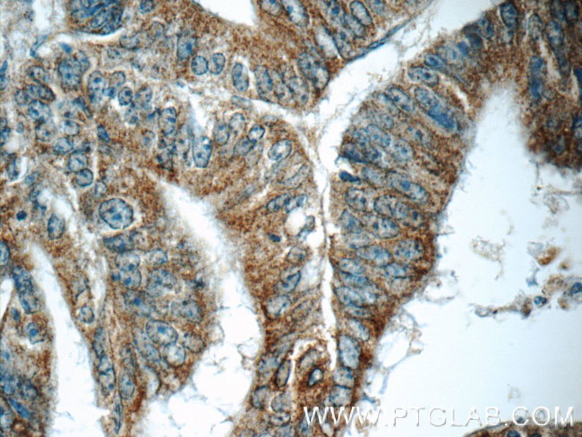 ARAP3 Antibody in Immunohistochemistry (Paraffin) (IHC (P))
