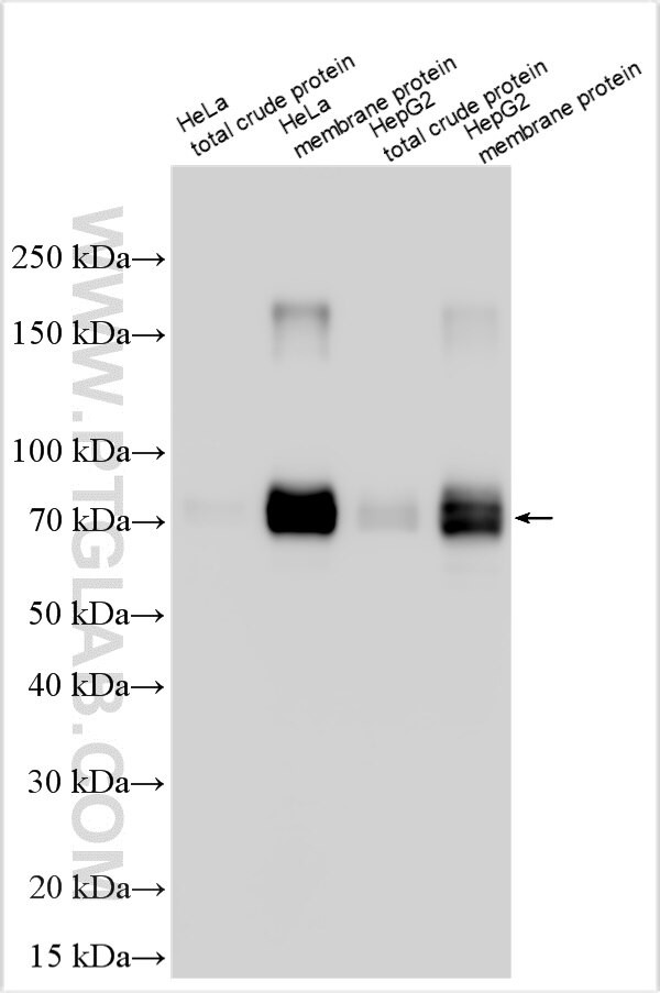MUPP1 Antibody in Western Blot (WB)