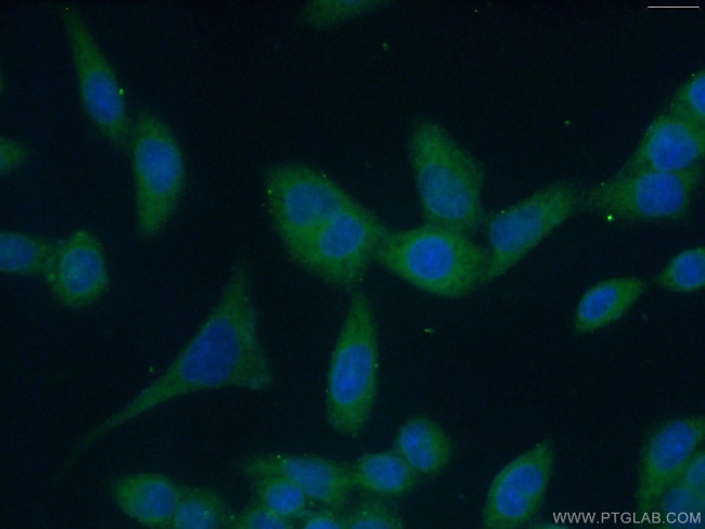 BCR Antibody in Immunocytochemistry (ICC/IF)