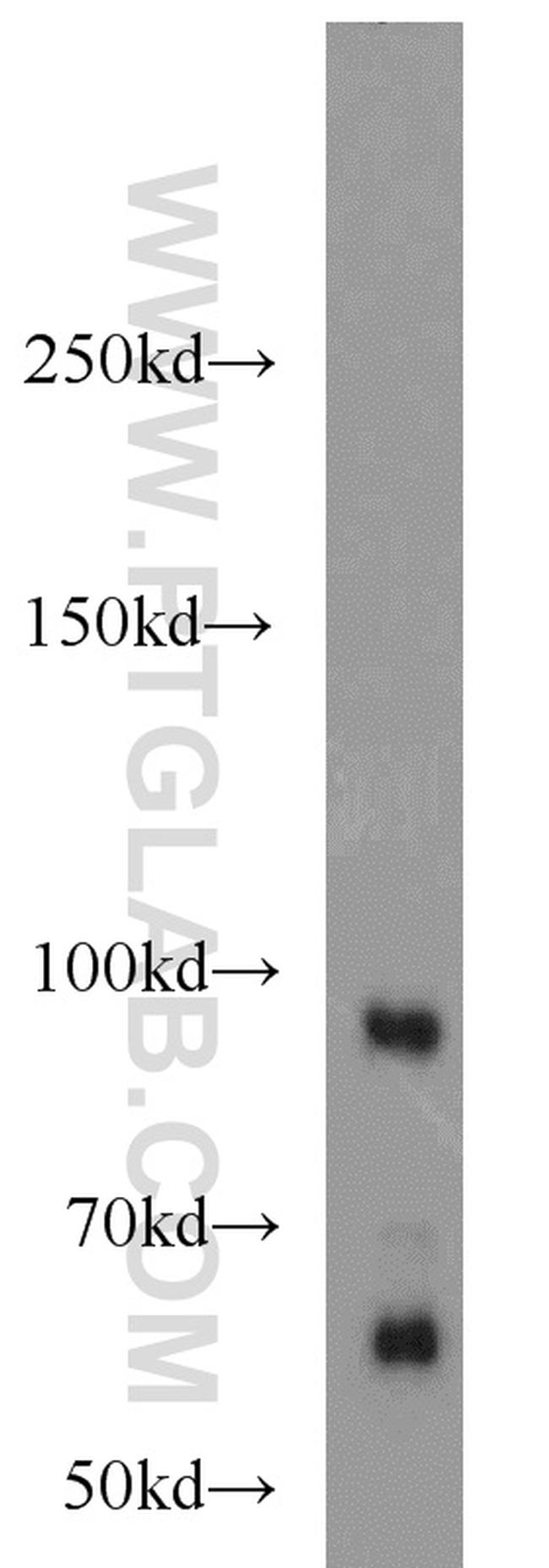 PRICKLE1 Antibody in Western Blot (WB)
