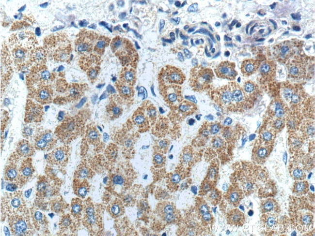 FNDC3B Antibody in Immunohistochemistry (Paraffin) (IHC (P))