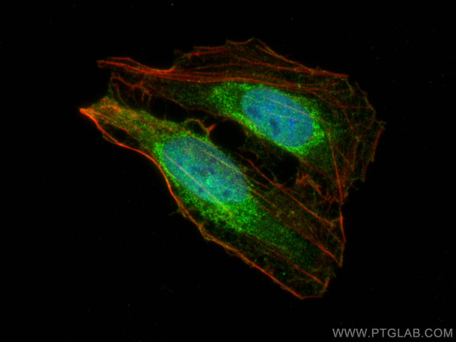 TET3 Antibody in Immunocytochemistry (ICC/IF)