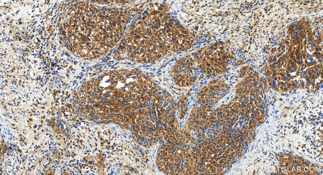 MAGI3 Antibody in Immunohistochemistry (Paraffin) (IHC (P))