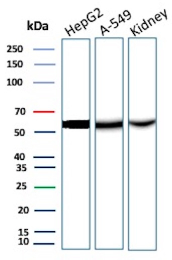 D-Dimer/Fibrinogen gamma chain Antibody in Western Blot (WB)