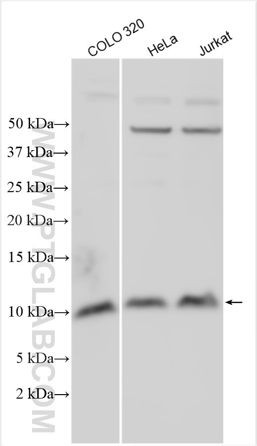 SLC30A1 Antibody in Western Blot (WB)