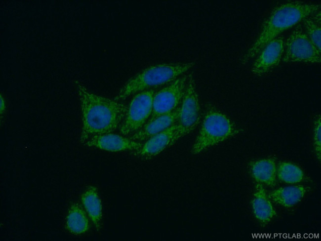 PPP4R2 Antibody in Immunocytochemistry (ICC/IF)