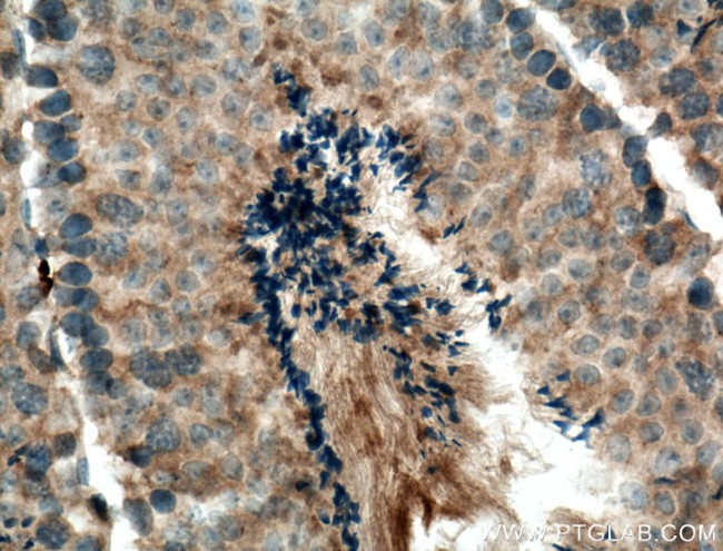 HERC5 Antibody in Immunohistochemistry (Paraffin) (IHC (P))