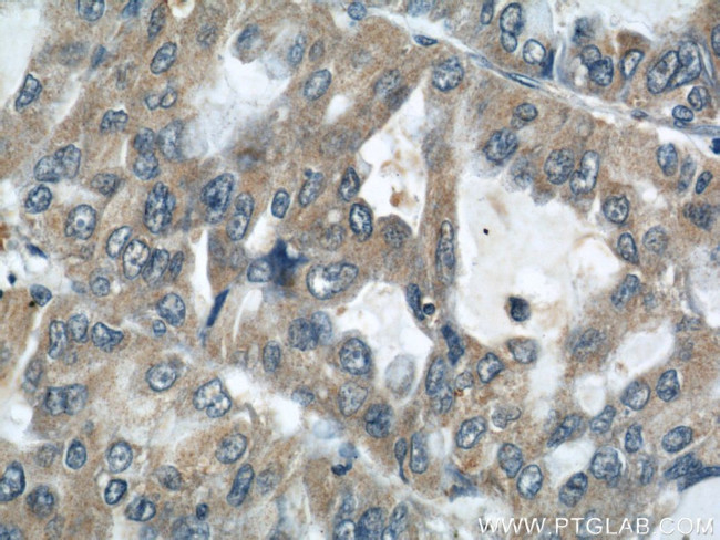 AARS2 Antibody in Immunohistochemistry (Paraffin) (IHC (P))