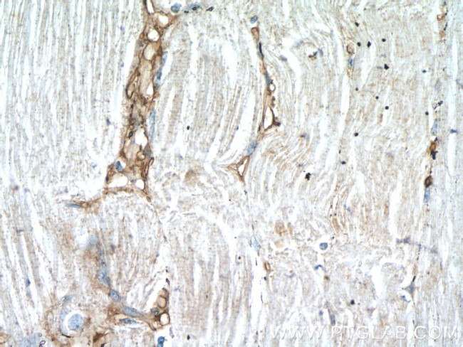 DOK7 Antibody in Immunohistochemistry (Paraffin) (IHC (P))