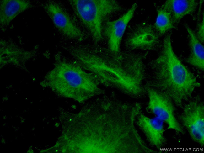 EML4 Antibody in Immunocytochemistry (ICC/IF)