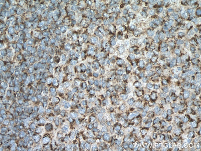 SLAMF6 Antibody in Immunohistochemistry (Paraffin) (IHC (P))