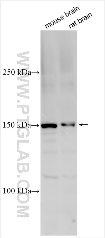 CHD5 Antibody in Western Blot (WB)