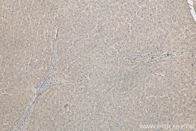 RWDD3 Antibody in Immunohistochemistry (Paraffin) (IHC (P))