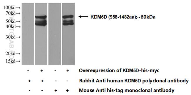 KDM5D Antibody in Western Blot (WB)