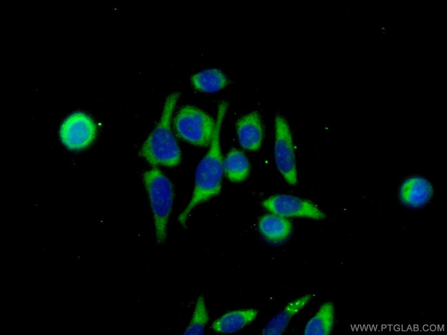 GDEP Antibody in Immunocytochemistry (ICC/IF)