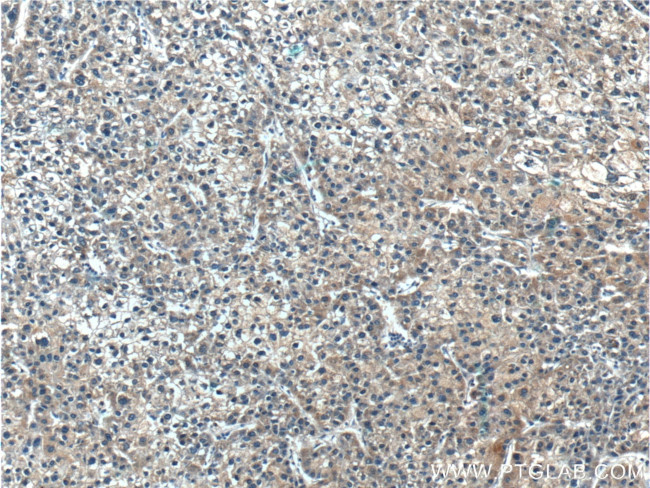 SARDH Antibody in Immunohistochemistry (Paraffin) (IHC (P))