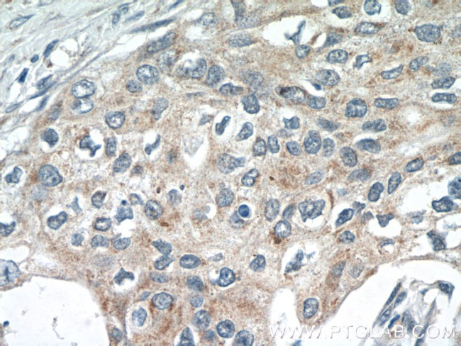 SPRY4 Antibody in Immunohistochemistry (Paraffin) (IHC (P))