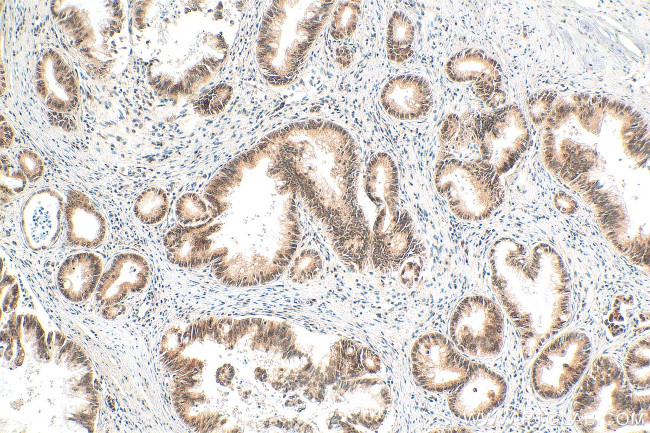 NOP10 Antibody in Immunohistochemistry (Paraffin) (IHC (P))
