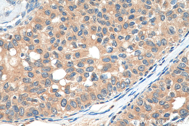 CCDC64B Antibody in Immunohistochemistry (Paraffin) (IHC (P))