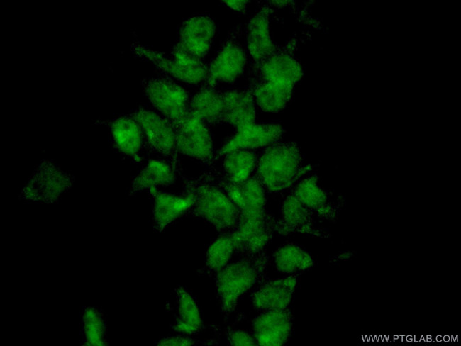 MIXL1 Antibody in Immunocytochemistry (ICC/IF)