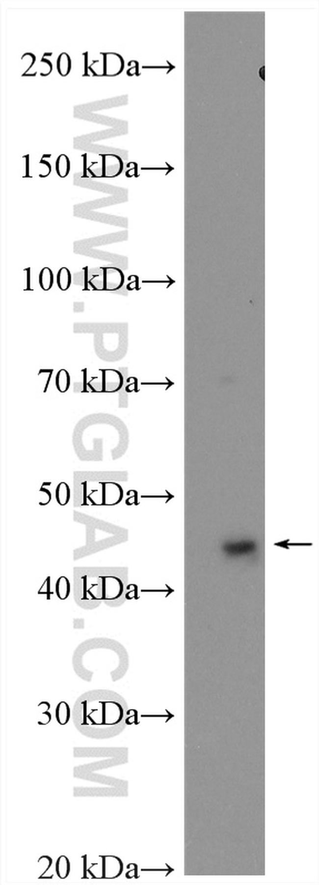 TWISTNB Antibody in Western Blot (WB)