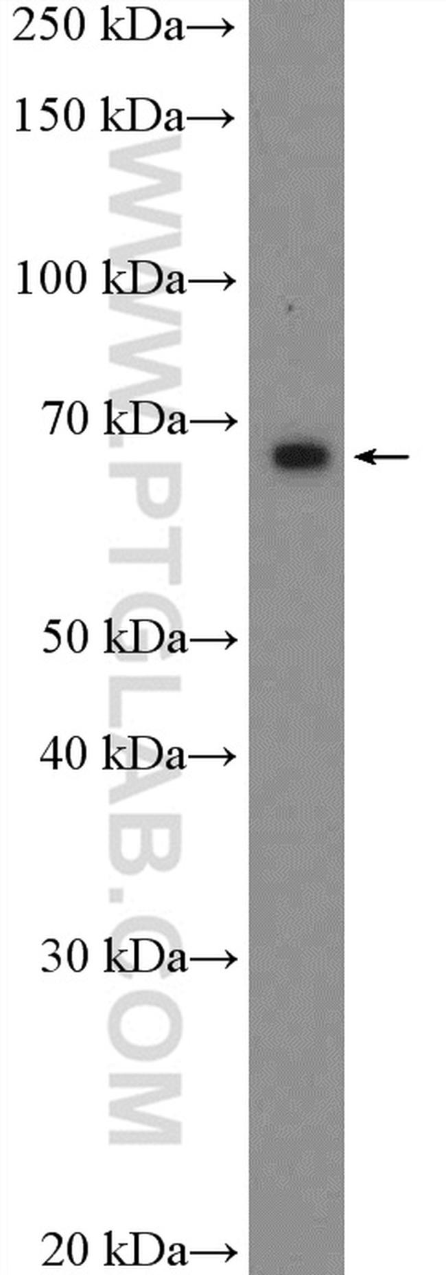 HIC2 Antibody in Western Blot (WB)