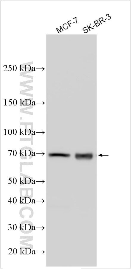 KRT28 Antibody in Western Blot (WB)