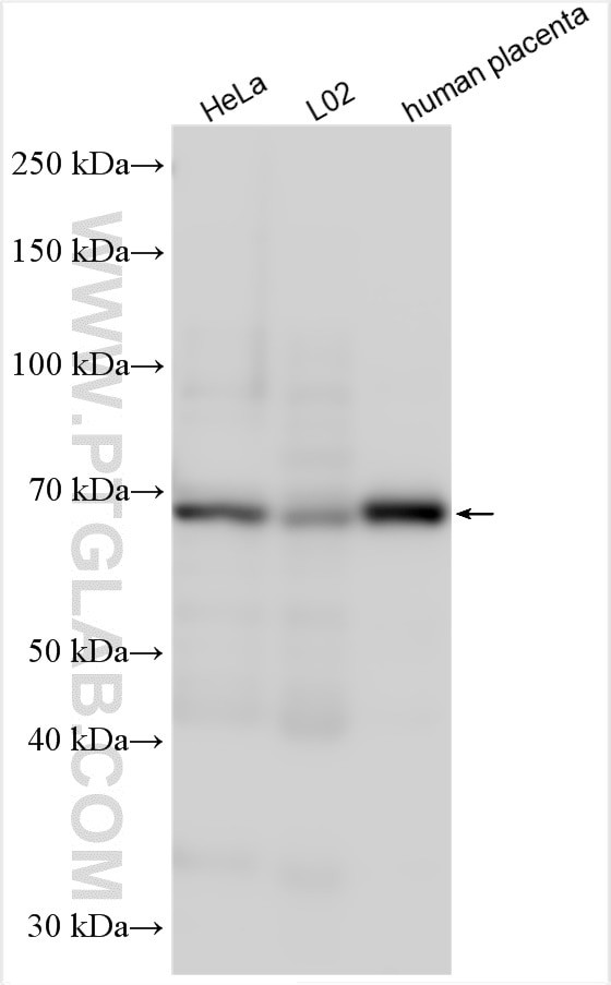 SLCO1B3/OATP1B3 Antibody in Western Blot (WB)