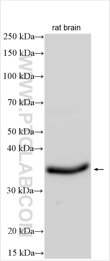 GATSL2 Antibody in Western Blot (WB)
