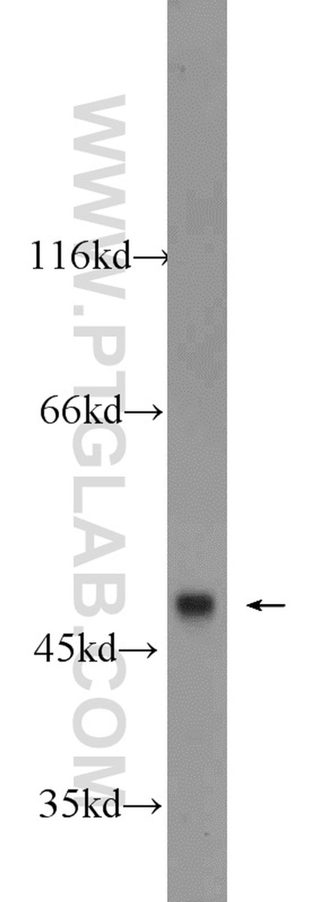 BMP10 Antibody in Western Blot (WB)