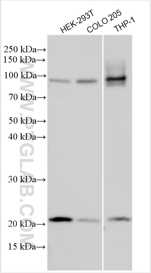 ADAM33 Antibody in Western Blot (WB)