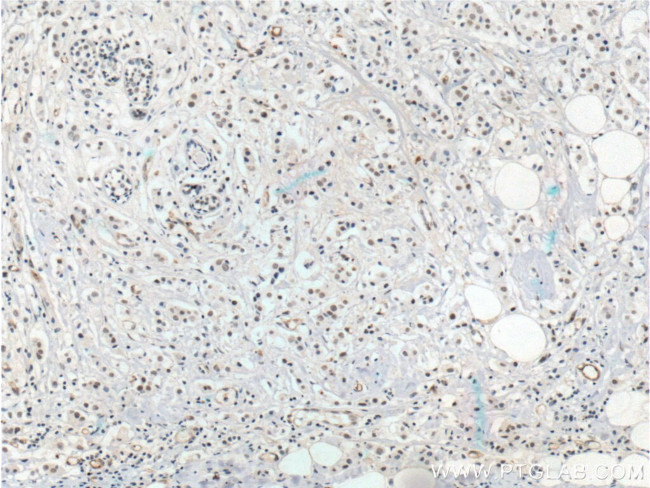 LMTK3 Antibody in Immunohistochemistry (Paraffin) (IHC (P))