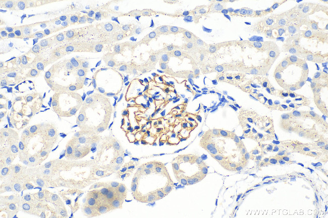 Nephrin Antibody in Immunohistochemistry (Paraffin) (IHC (P))