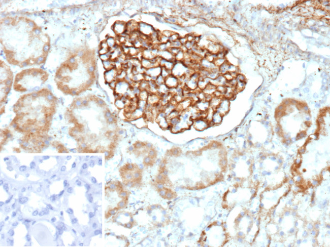 PLA2R1/Phospholipase A2 Receptor 1 Antibody in Immunohistochemistry (Paraffin) (IHC (P))