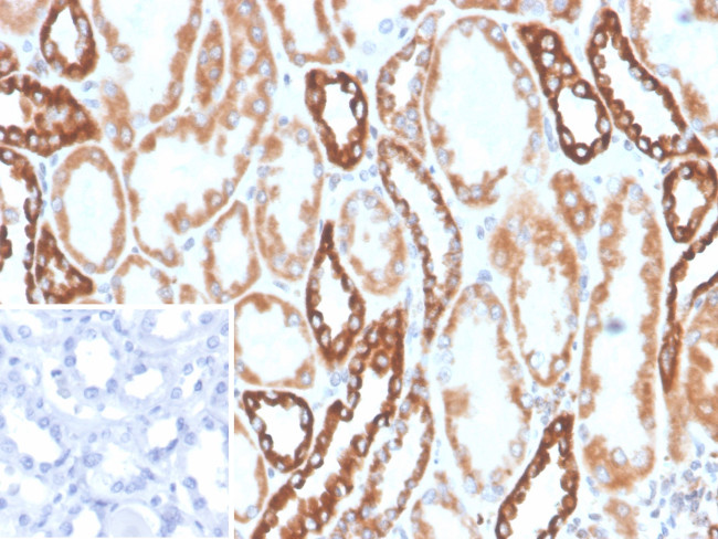 PLA2R1/Phospholipase A2 Receptor 1 Antibody in Immunohistochemistry (Paraffin) (IHC (P))