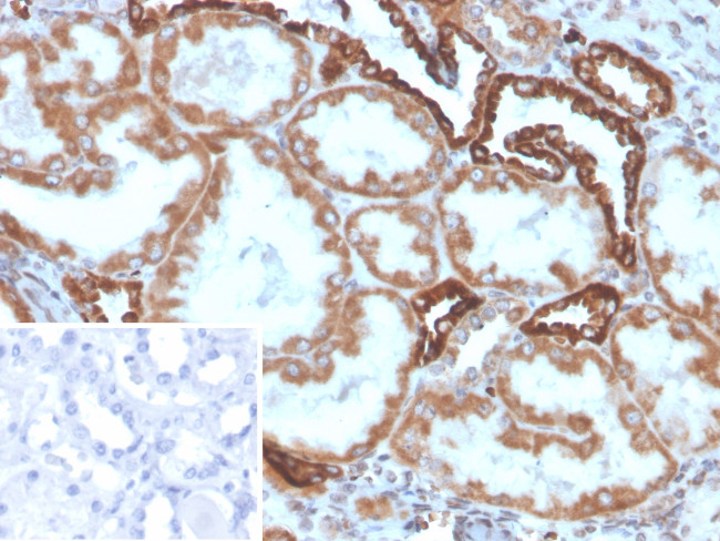 PLA2R1/Phospholipase A2 Receptor 1 Antibody in Immunohistochemistry (Paraffin) (IHC (P))