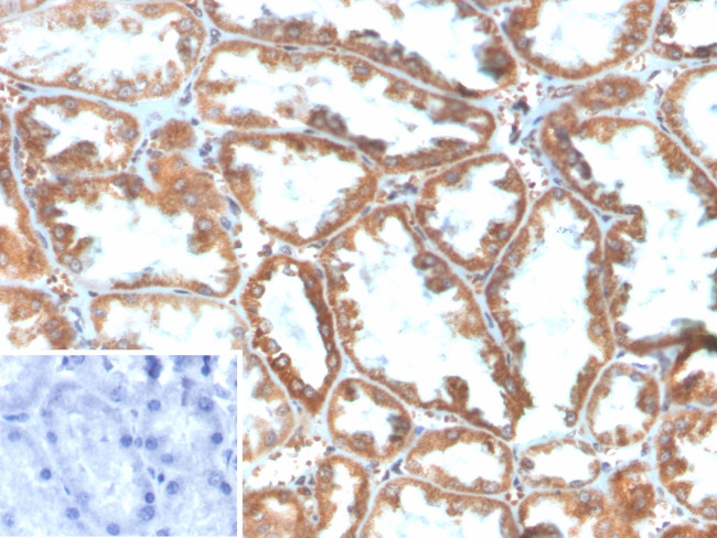 PLA2R1/Phospholipase A2 Receptor 1 Antibody in Immunohistochemistry (Paraffin) (IHC (P))