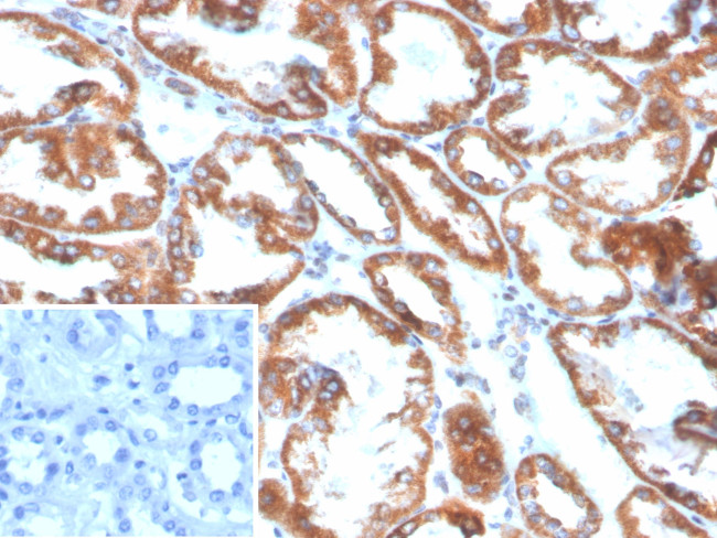 PLA2R1/Phospholipase A2 Receptor 1 Antibody in Immunohistochemistry (Paraffin) (IHC (P))
