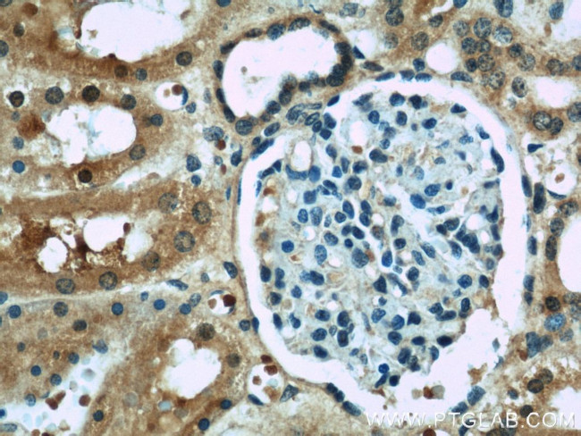 ACOT6 Antibody in Immunohistochemistry (Paraffin) (IHC (P))