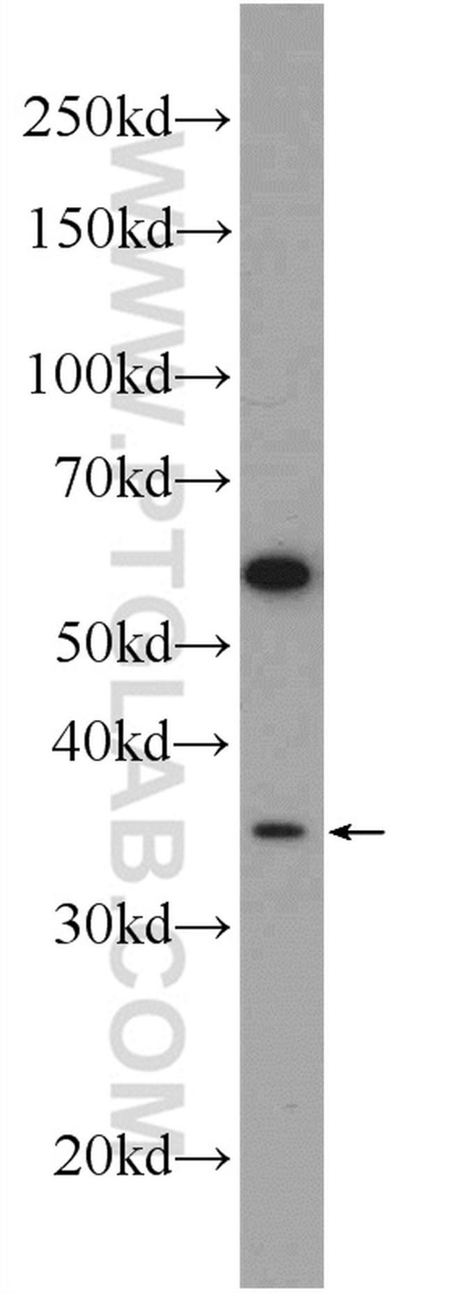 CDX4 Antibody in Western Blot (WB)
