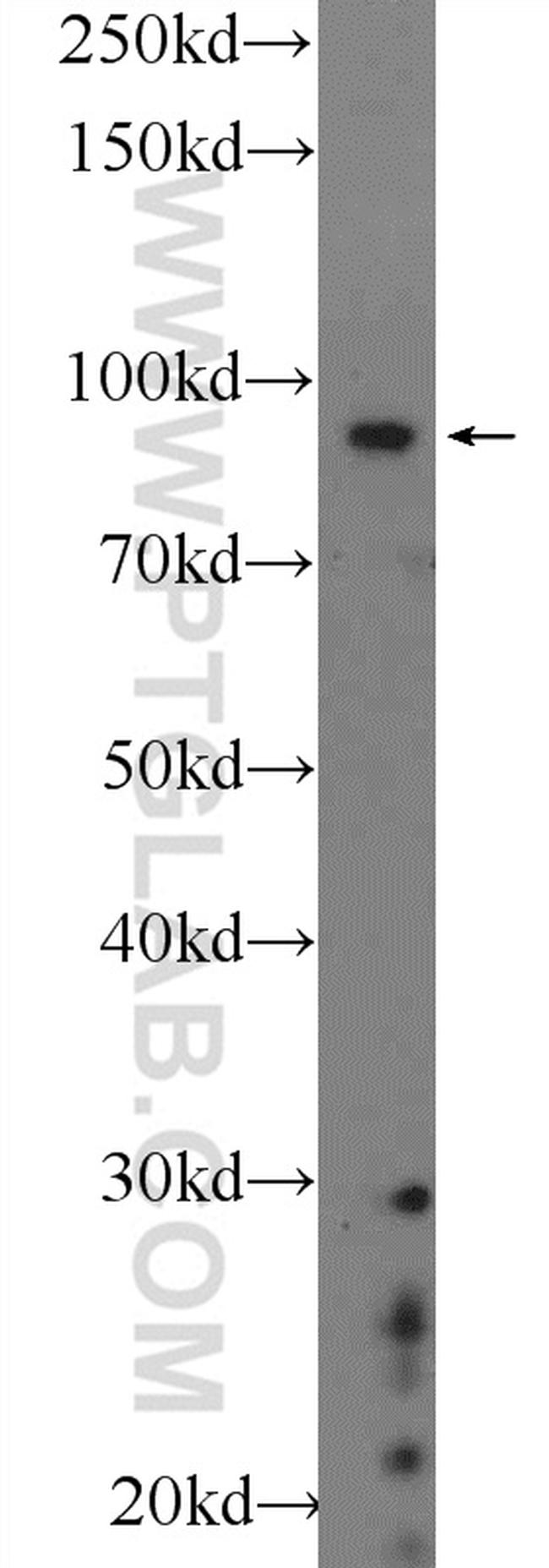 BARD1 Antibody in Western Blot (WB)
