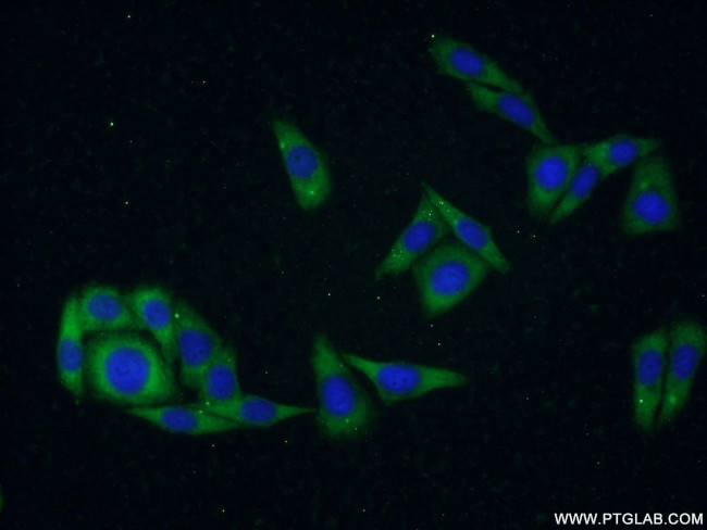 CDKAL1 Antibody in Immunocytochemistry (ICC/IF)