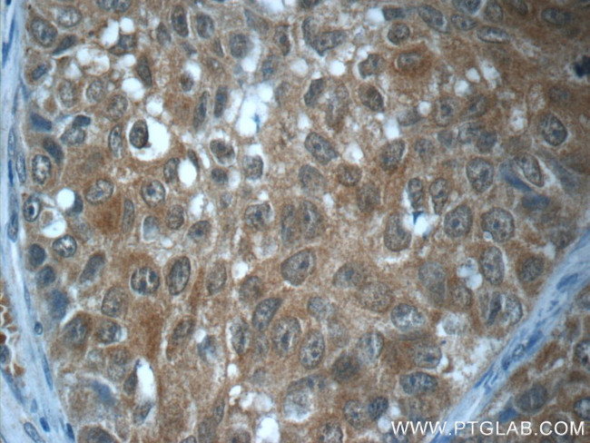 GBP6 Antibody in Immunohistochemistry (Paraffin) (IHC (P))