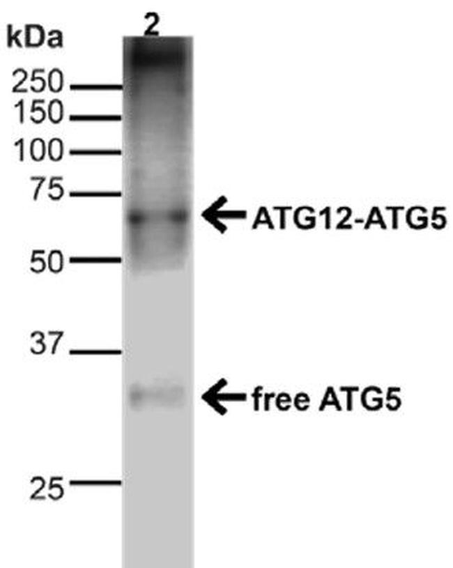 Atg5 Antibody in Western Blot (WB)