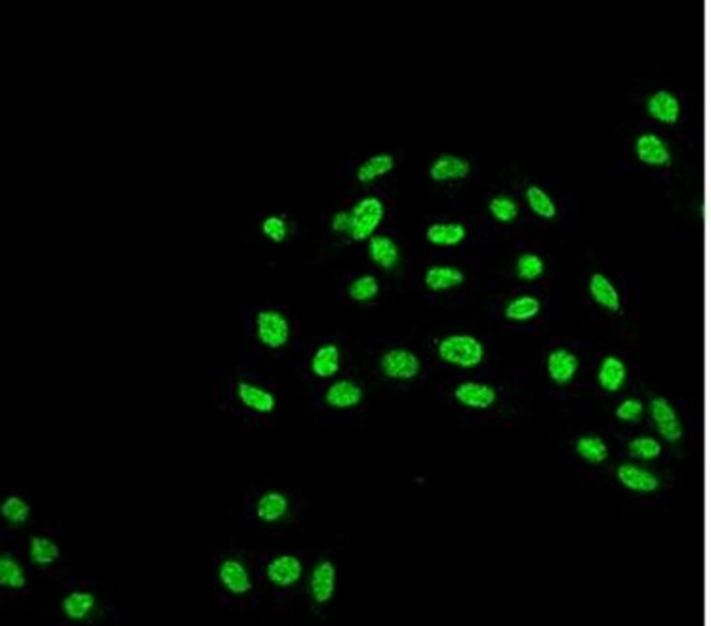 Atg5 Antibody in Immunocytochemistry (ICC/IF)
