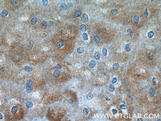 SPRR2D Antibody in Immunohistochemistry (Paraffin) (IHC (P))