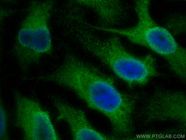 IL-4I1 Antibody in Immunocytochemistry (ICC/IF)