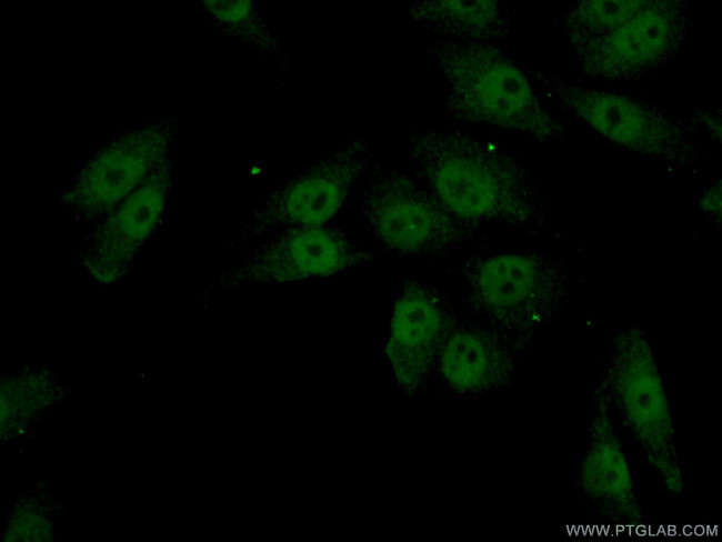 FOXC2 Antibody in Immunocytochemistry (ICC/IF)