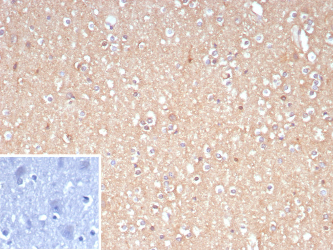 FOXO1 (Forkhead box O1) (Transcription Factor) Antibody in Immunohistochemistry (Paraffin) (IHC (P))
