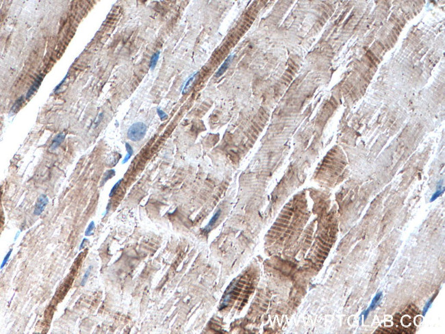 Alpha cardiac muscle actin Antibody in Immunohistochemistry (Paraffin) (IHC (P))